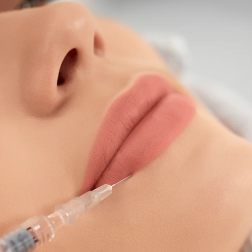 MESOTHERAPY